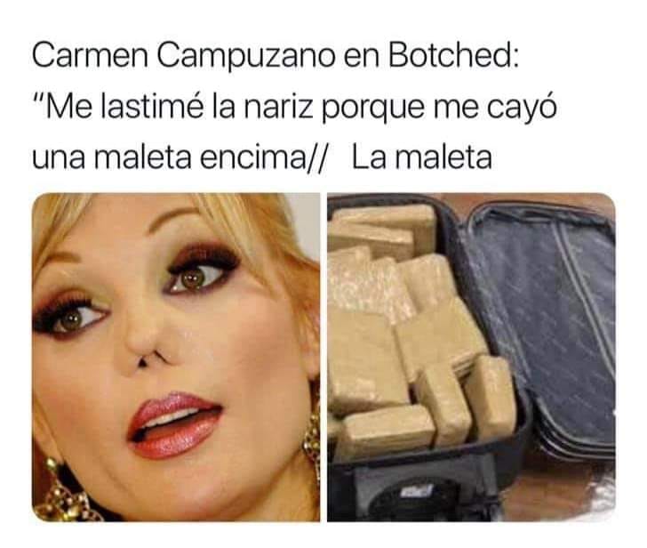Carmen Campuzano en Botched:  "Me lastimé la nariz porque me cayó una maleta encima." // La maleta.