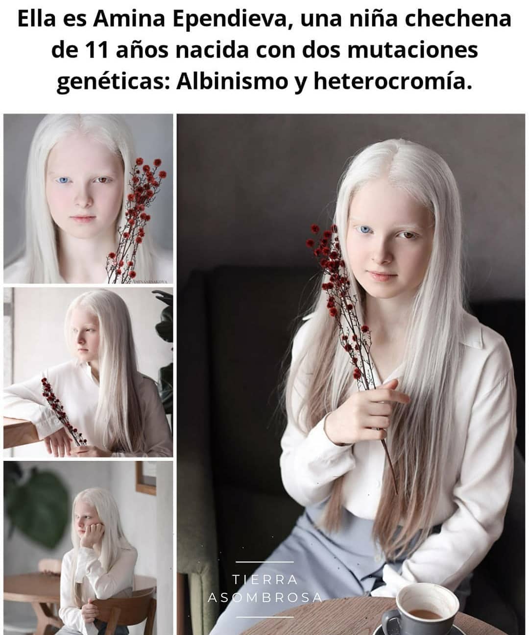 Ella es Amina Ependieva, una niña chechena de 11 años nacida con dos mutaciones genéticas: Albinismo y heterocromía.