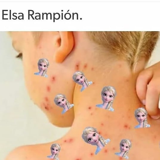 Elsa Rampión.