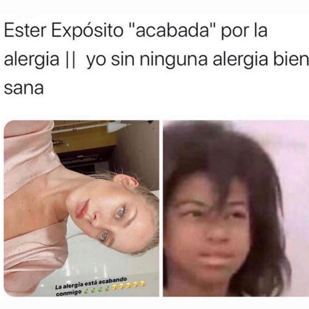 Ester Expósito "acabada" por la alergia. // Yo sin ninguna alergia bien sana.