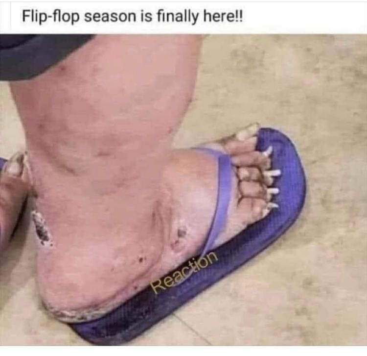 Flip-flop season is finally here!!