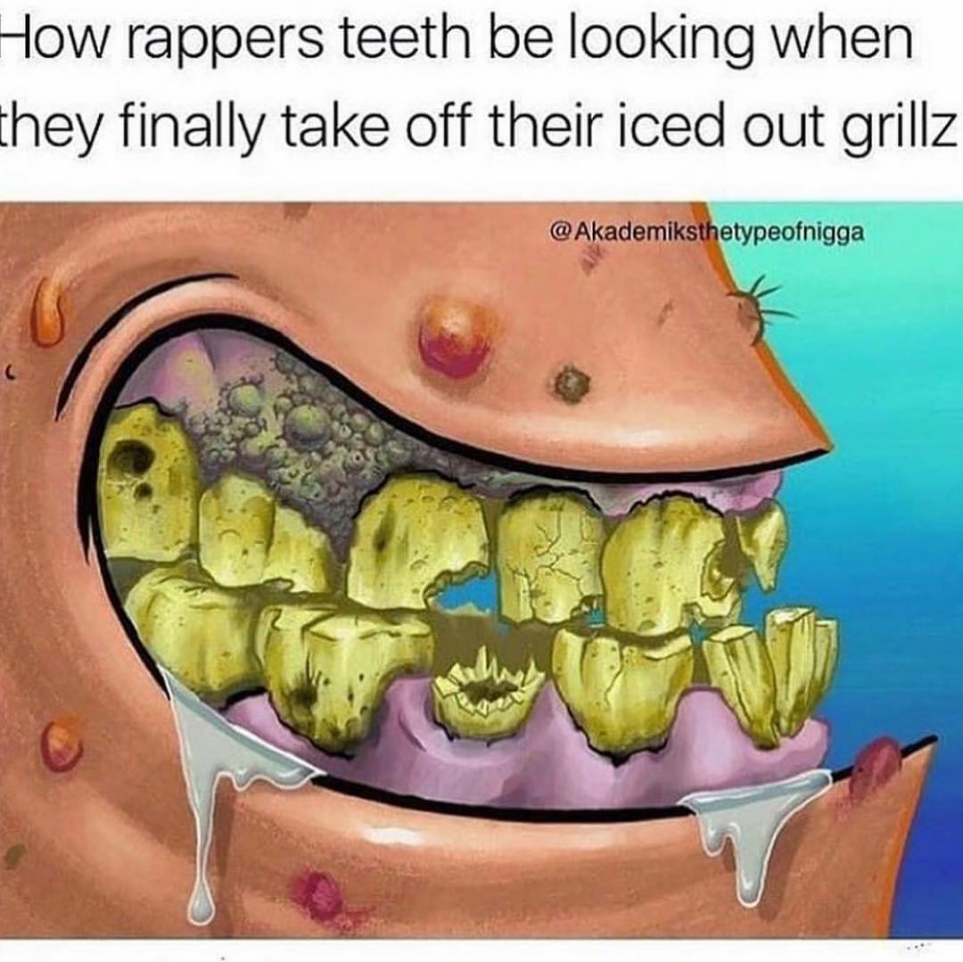 How rappers teeth be looking when hey finally take off their iced out grill.