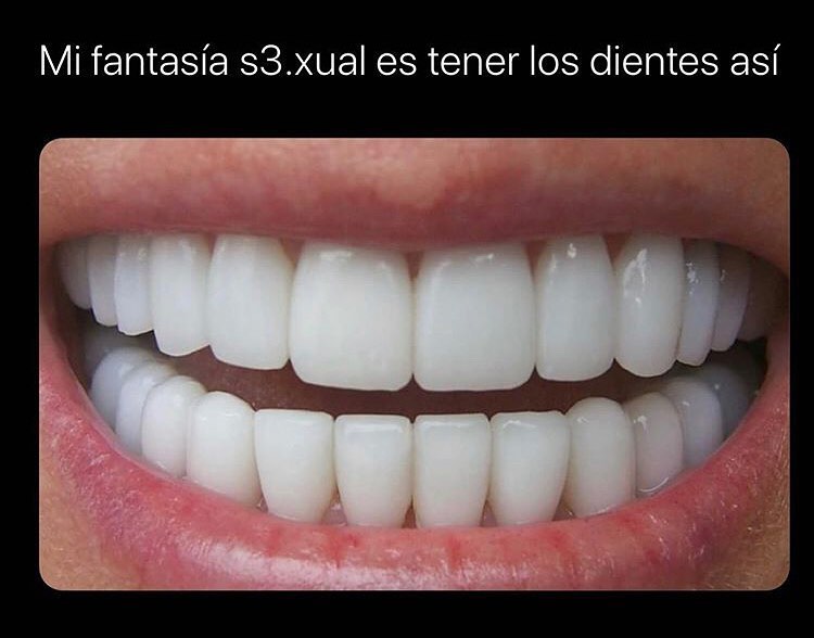Mi fantasía s3.xual es tener los dientes así.