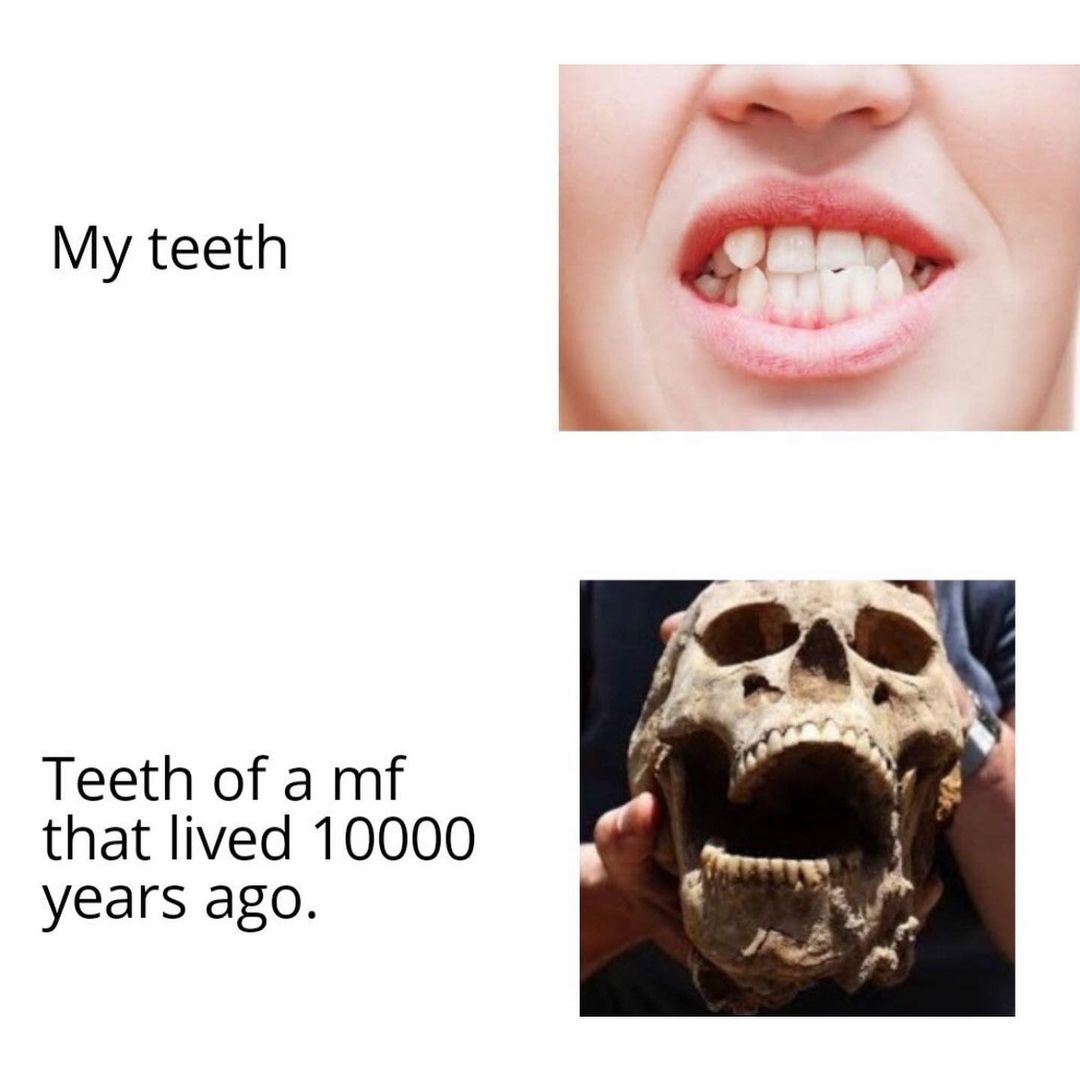 My teeth. Teeth of a mf that lived 10000 years ago.