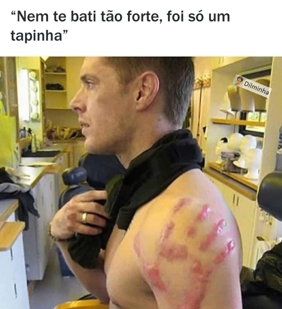 Nem te bati tão forte, foi só um tapinha.