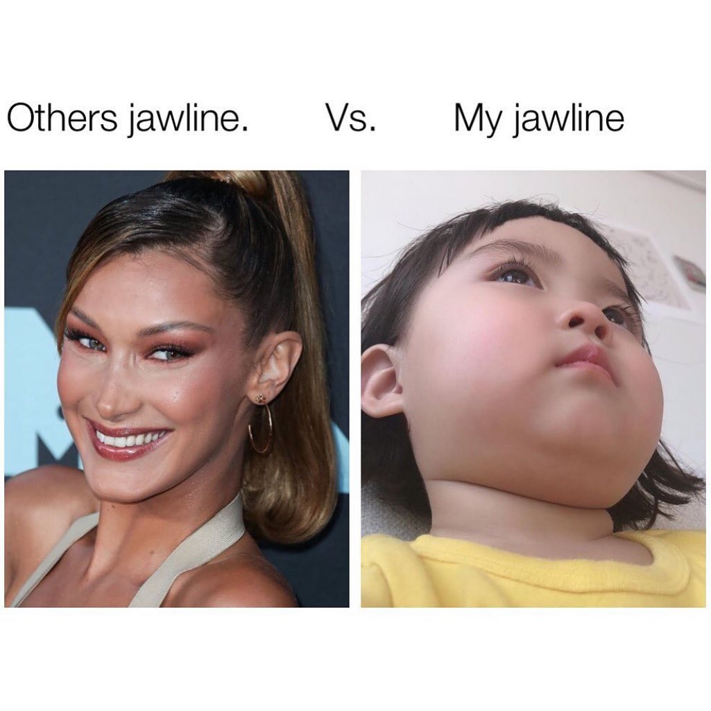 Others jawline. Vs. My jawline.