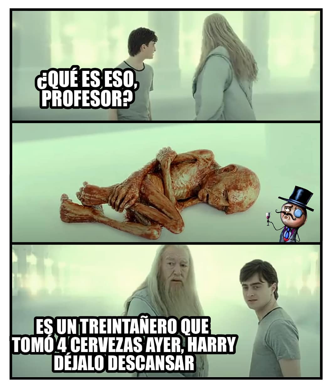 ¿Qué es eso, profesor? Es un treintañero que tomó 4 cervezas ayer, Harry déjalo descansar.