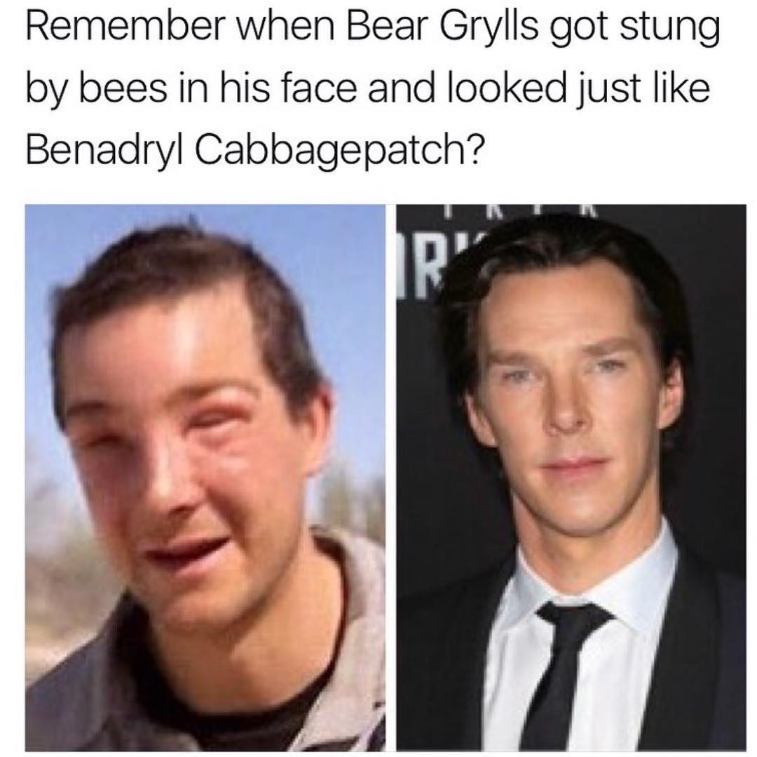 Remember when Bear Grylls got stung by bees in his face and looked just like Benadryl Cabbagepatch?