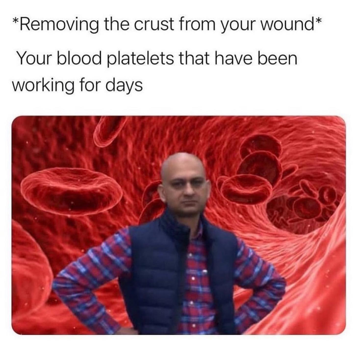 *Removing the crust from your wound* Your blood platelets that have been working for days.