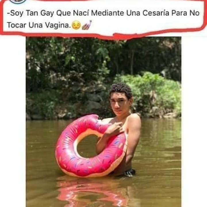 Soy Tan Gay Que Nací Mediante Una Cesaria Para No Tocar Una Vagina.
