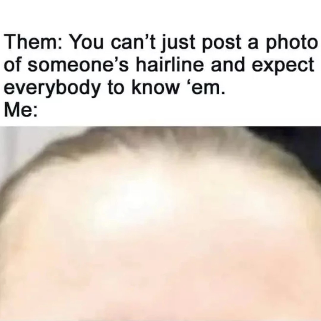 Them: You can't just post a photo of someone's hairline and expect everybody to know 'em.  Me:
