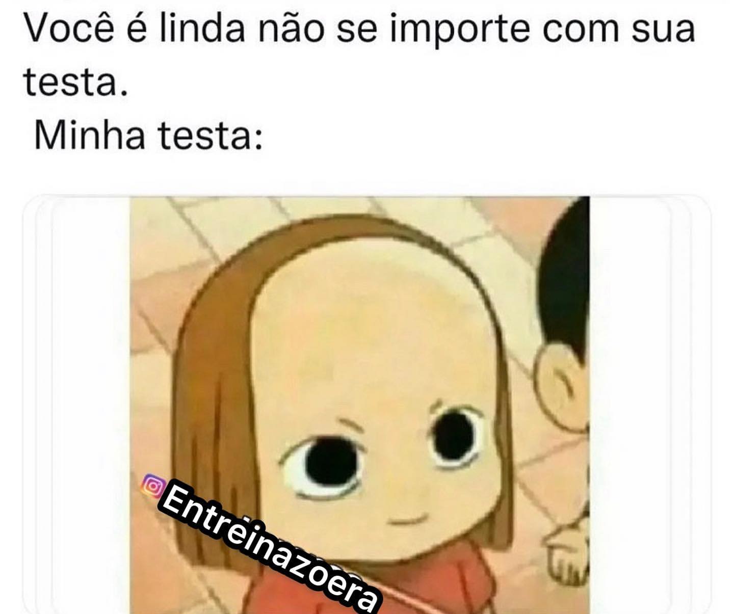 Você é linda não se importe com sua testa. Minha testa: