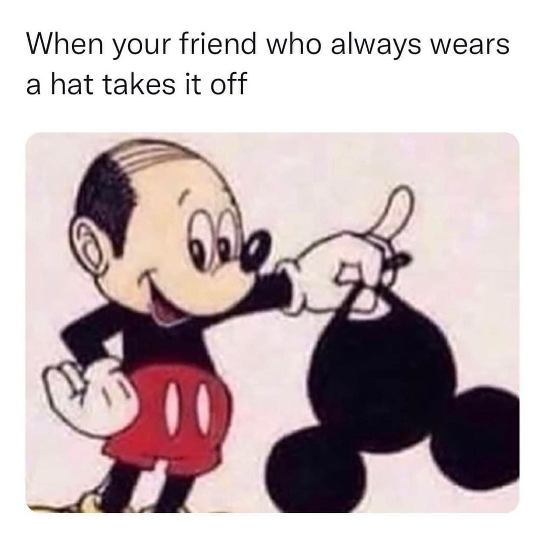 When your friend who always wears a hat takes it off.
