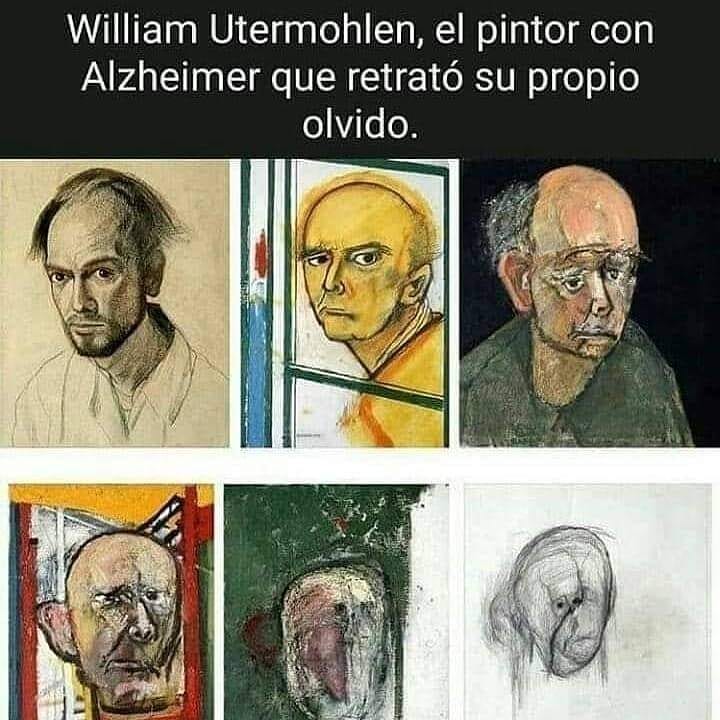 William Utermohlen, el pintor con Alzheimer que retrató su propio olvido.
